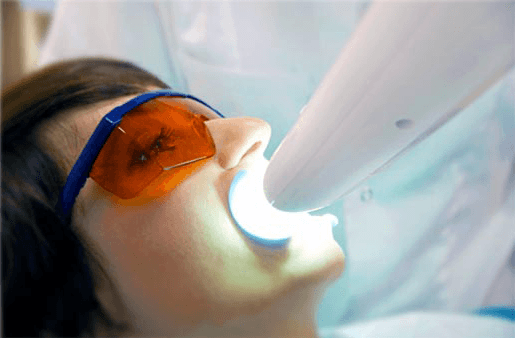 Understanding the Causes of Teeth Sensitivity Reading