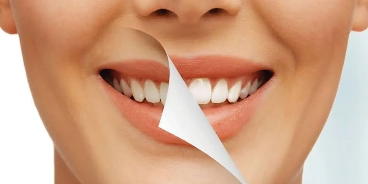 Can Laser Teeth Whitening Damage Your Dental Crowns Reading?