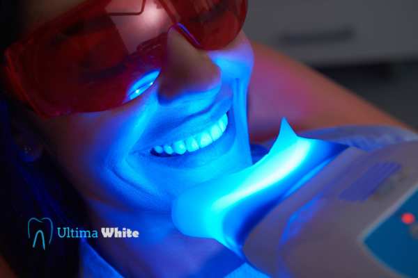 Professional Teeth Whitening Options Reading