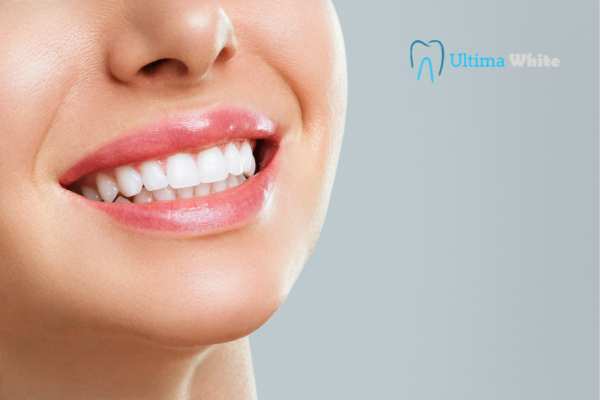Common Mistakes That Can Ruin Your Whitening Results Reading