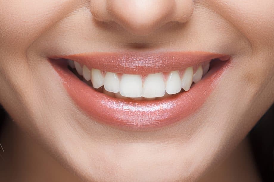 Why Do Some Teeth Whitening Results Fade Faster Than Others Reading?