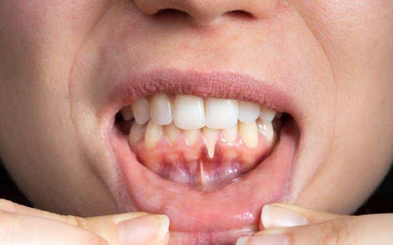 Final Thoughts: Building Lifelong Enamel Protection Habits Reading