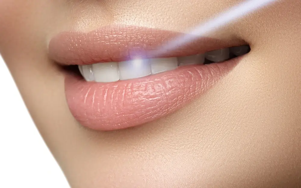 Understanding Teeth Whitening Risks and Results Reading