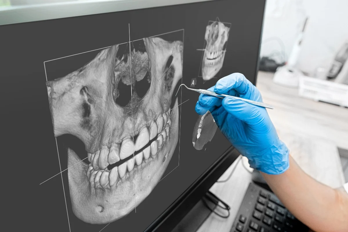 Key Benefits of 3D Printing for Patients and Dentists Reading