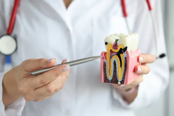 Which Whitening Methods Are Gentler on Sensitive Teeth Reading?