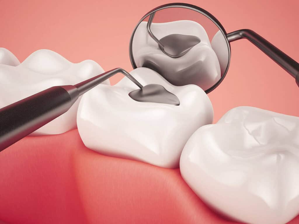 Fighting Cavities and Plaque Buildup Reading