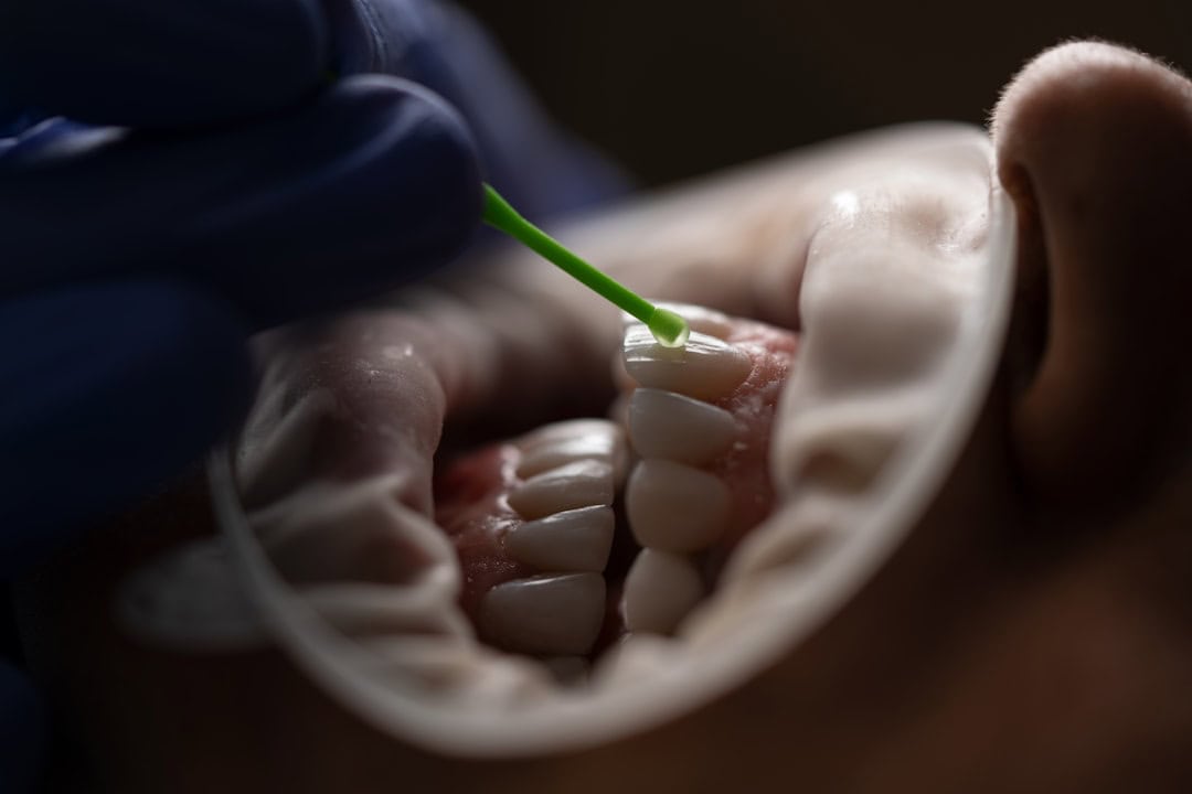 How Saliva Protects Your Teeth and Gums Reading