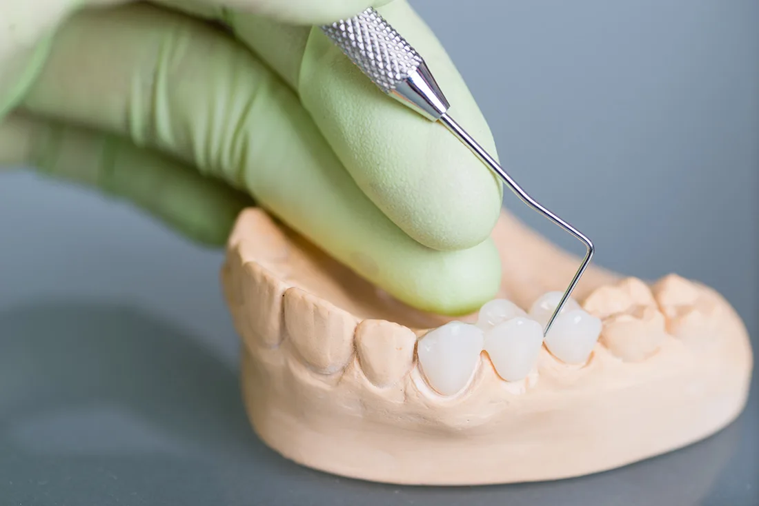 Do Braces Take Years to Show Results Reading
