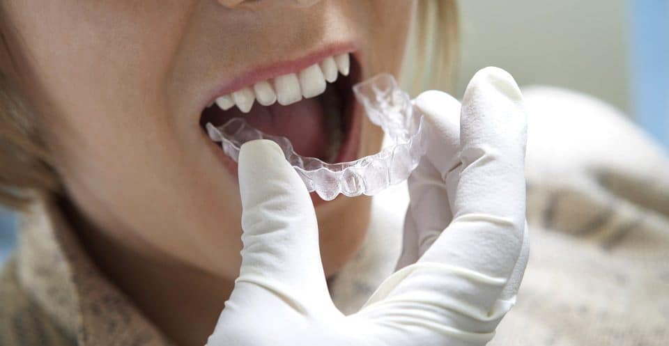 Can Bruxism Affect Your Sleep Quality Reading
