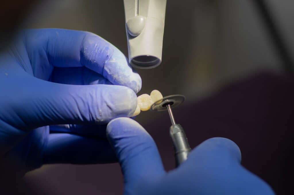 Customised Dental Solutions: Crowns, Aligners, and Implants Reading
