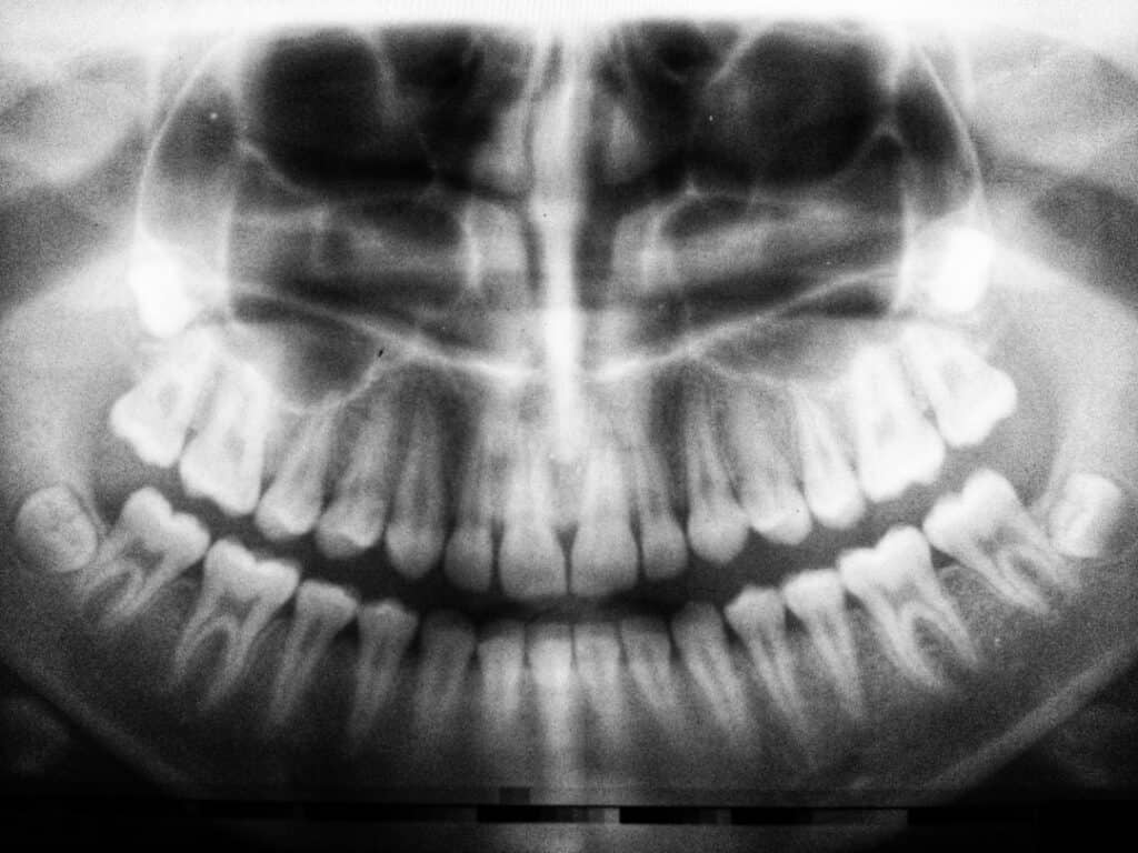 The Future of 3D Printing in Oral Healthcare Reading